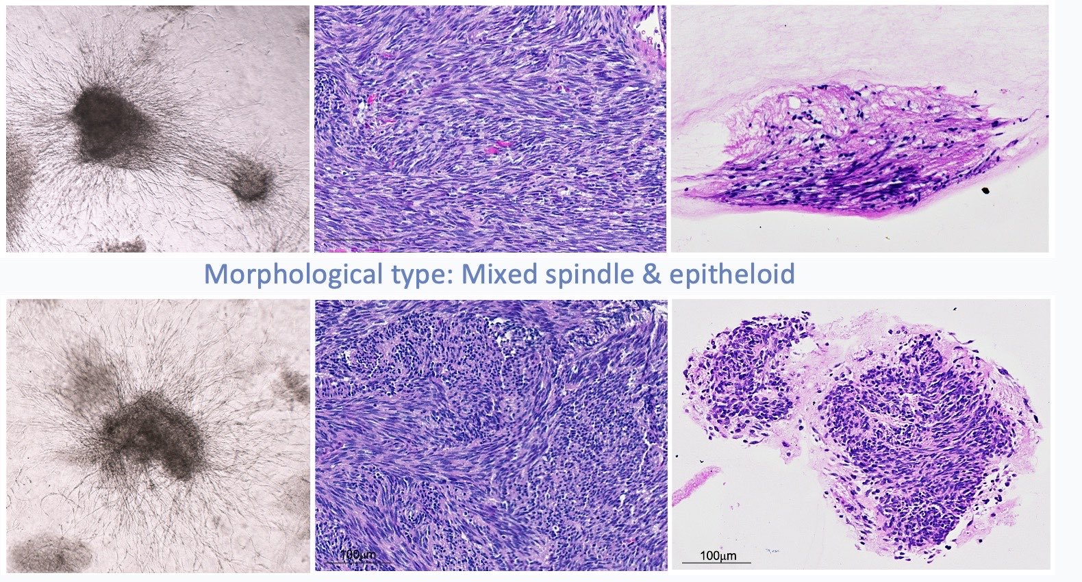 Two GIST morphology groups comparing tissue-derived cultures, source-tissue H&E and culture H&E